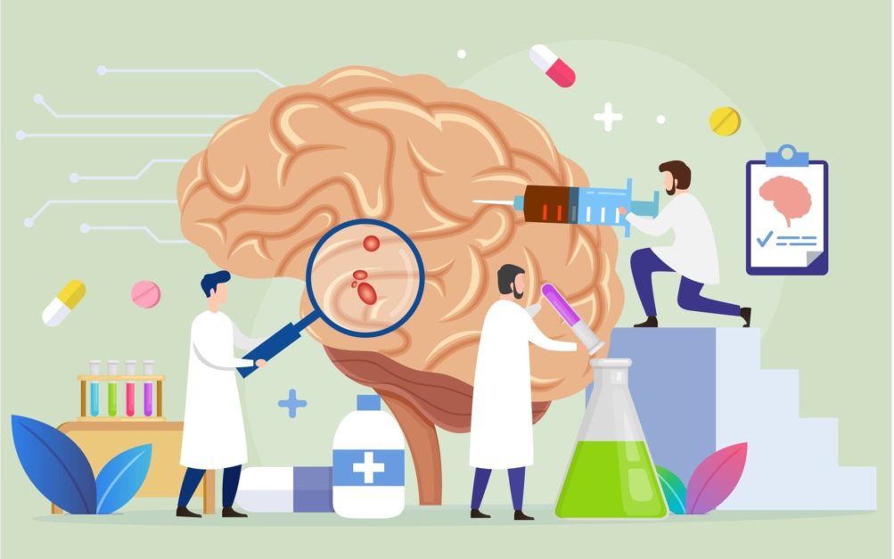 animaion of multiple doctors examining and treating brain