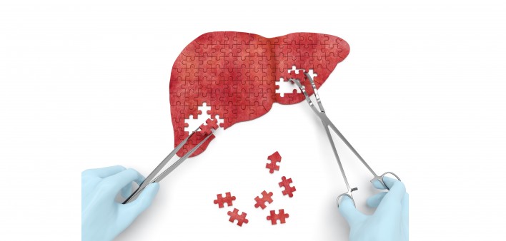 animation of liver transplant