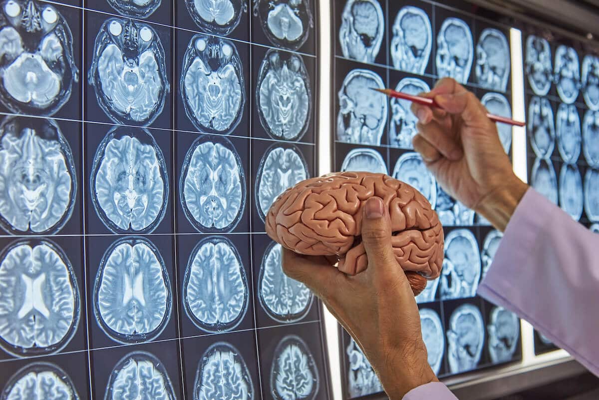 Neurosurgeon holding a brain model in his hand