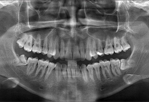 X-ray at Al-tamash Hospital 